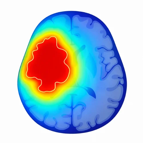 Comparison chart of Gamma Knife vs Zap-X and CyberKnife for brain tumor precision