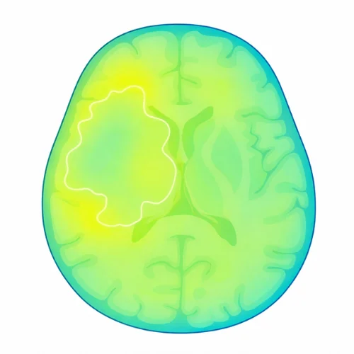 Comparison chart of Gamma Knife vs Zap-X and CyberKnife for brain tumor precision