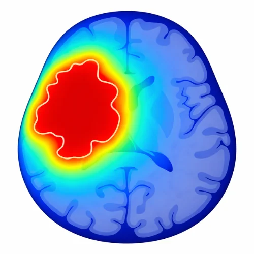 Comparison chart of Gamma Knife vs Zap-X and CyberKnife for brain tumor precision